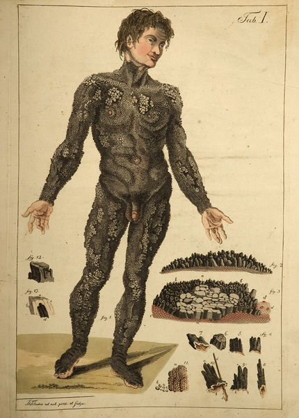 Datei:Tilesius.jpg